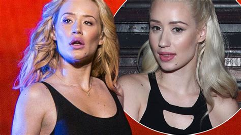 Iggy Azalea Confirms She S Had A Nose Job After Admitting To Having