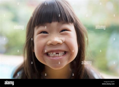 Grinning Girl With Missing Tooth Stock Photo Alamy