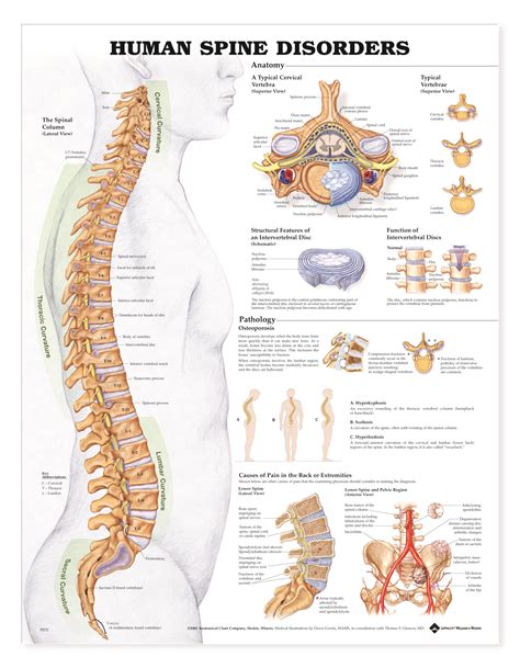 Bone science human diagram anchor chart human body health back skeleton. Human Spine Disorders - Charts | 2422