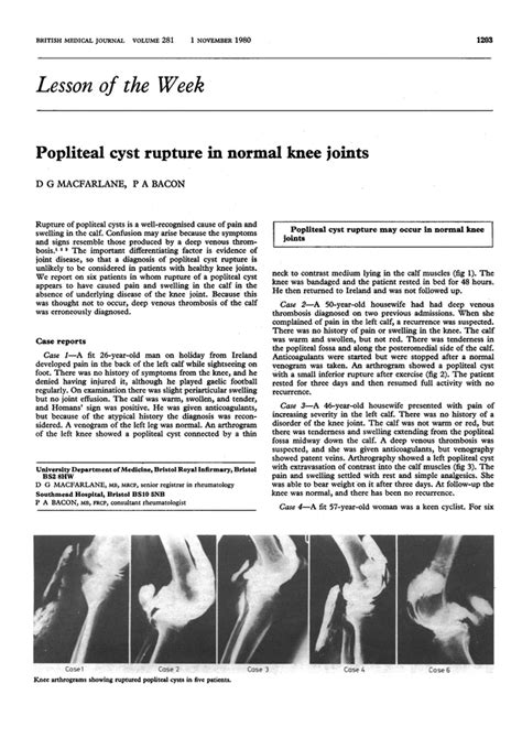 Popliteal Cyst Rupture In Normal Knee Joints The Bmj