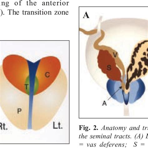 Zonal Anatomy Of Prostate Anatomy Drawing Diagram