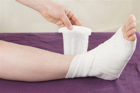 Ankle sprain recovery time and exercises. How to Reduce Ankle Sprain Swelling | Sprained ankle ...