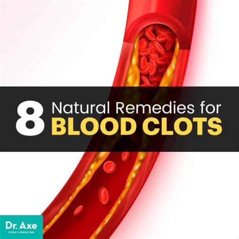 Blood Clots Causes And Symptoms 8 Natural Remedies Dr Axe