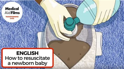 How To Resuscitate A Newborn Baby Youtube