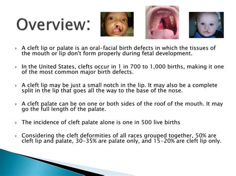 Ppt Cleft Lip And Cleft Palate Powerpoint Presentation Free Download