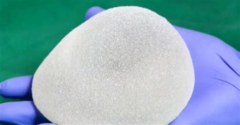 Breast Implants Recalled Amid Growing Links To Rare And Deadly Cancer