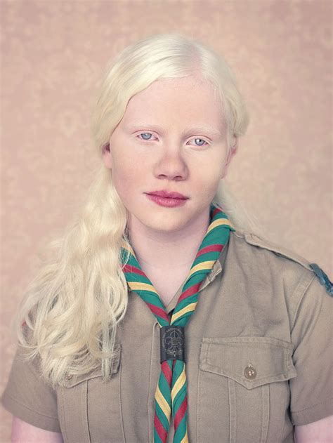 La Delicadeza Albina Modelo Albino Personas Albinas Gente Guapa