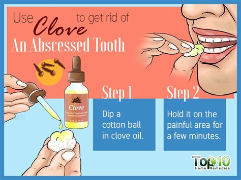 Tooth Abscess 10 Home Remedies To Help Manage The Infection Top 10