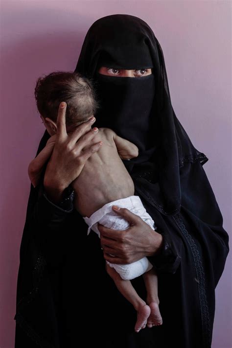 Starving mothers skip meals for their children in Yemen | New York Post
