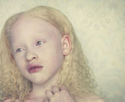 Gustavo Lacerda S Albinos Leave A Lasting Impression Albinism