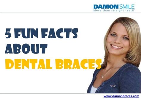 5 Fun Facts About Dental Braces