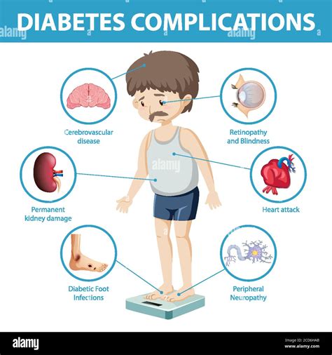Diabetes Complications Information Infographic Illustration Stock Hot Sex Picture