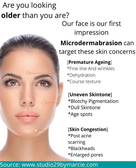 Microdermabrasion All You Need To Know Kdc Clinic