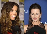 Kate Beckinsale Nose Job Plastic Surgery Before And After Photos | Nose ...