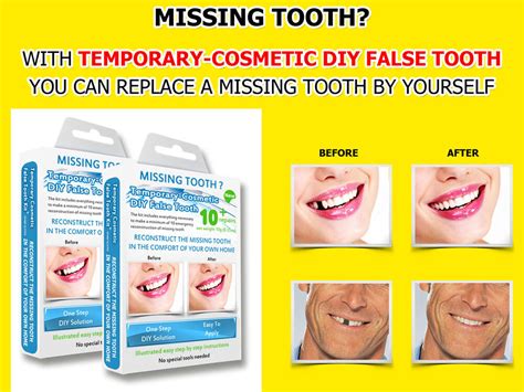 The dental health society does not recommend trying to fix a tooth without a dentist's help. 2x Temporary Missing Tooth Repair Kit TEETH REPLACEMENT ...