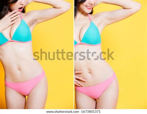 Asia Beauty Woman Wear Bikini With Armpit Hair Removal Problem Before And After Concept