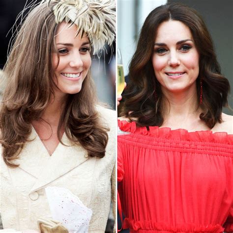 Does Kate Middleton Get Botox