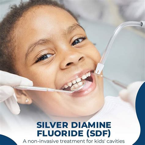 Silver Diamine Fluoride Sdf Childrens Dentists In Cary Raleigh