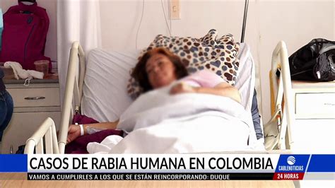 Al Menos Posibles Casos De Rabia Humana Se Atienden Al Mes En Bogot