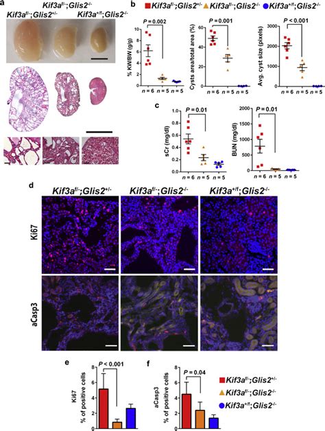 Loss Of Glis2nphp7 Causes Kidney Epithelial Cell Senescence And