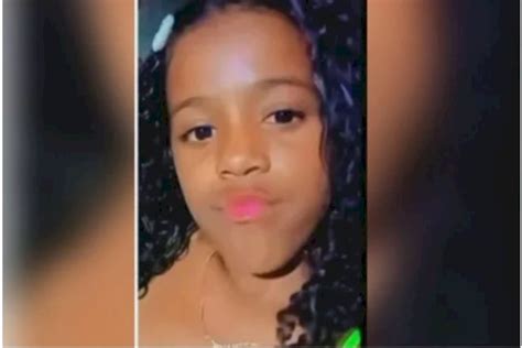 Menina De 11 Anos Tem Perna Amputada Após Acidente Em Carro Alegórico