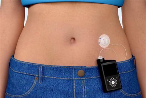 Best Technology And Gadgets For Diabetes Patients