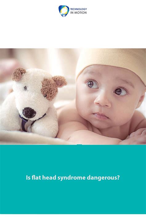 Is Flat Head Syndrome Dangerous Flat Head Syndrome Flat Head Syndrome