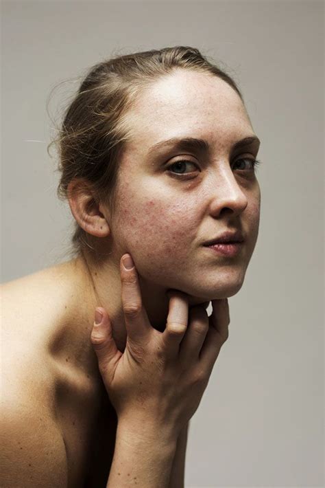 a woman with freckles on her face is posing for the camera while holding her hand to her chin