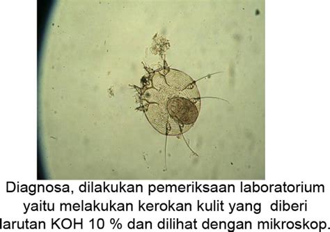 Includes dosages for scabies, ascariasis, cutaneous larva migrans and more; AVELLINO KENNEL: Demodex dan Scabies