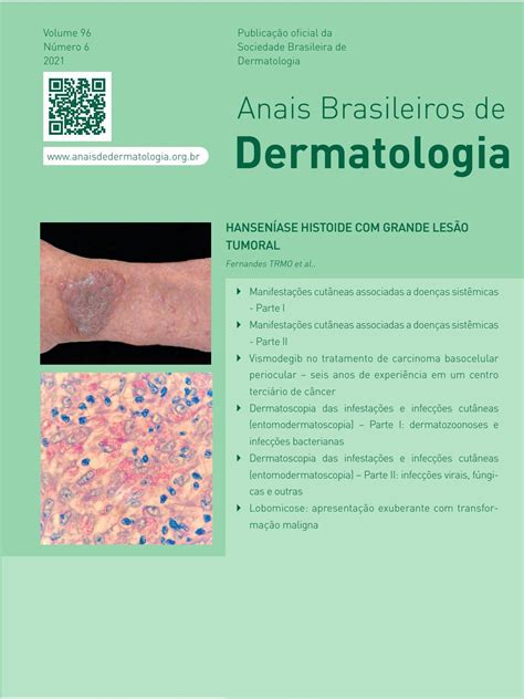 Anais Brasileiros De Dermatologia By Sociedade Brasileira De