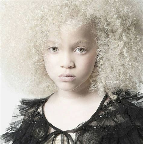 Ava Clarke Bowie Eyes Modelo Albino Hair Whorl Albino Girl Pretty