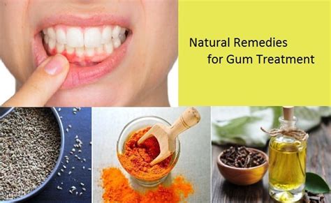 Natural Remedies For Gum Disease Trionds