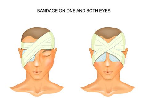 1100 Bandage On Eyes Illustrations Royalty Free Vector Graphics And Clip Art Istock