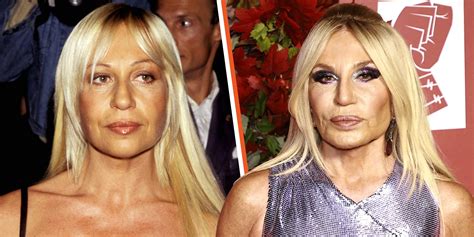 Before And After Donatella Versace Plastic Surgery The Hub