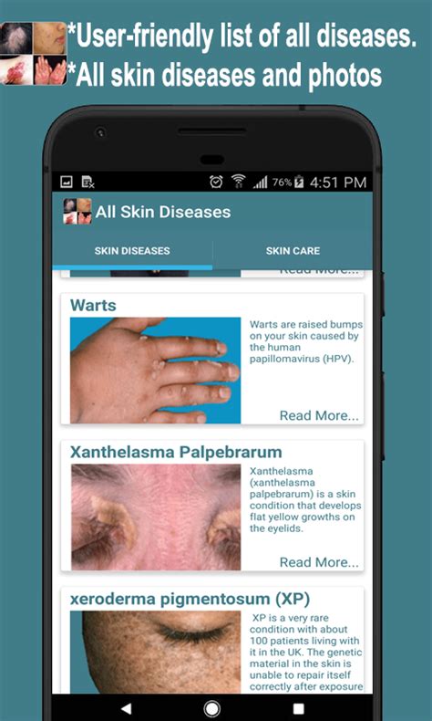 All Skin Diseases And Treatment A Zappstore For Android