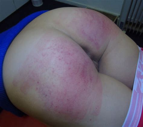 Thumbs Pro Spanked Wife Tumblr Com Post