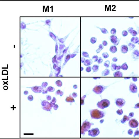 M1 And M2 Polarized Primary And Thp 1 Cells Differentially Express