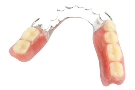 Full Vs Partial Dentures Understanding Your Options Harmony Dental Care