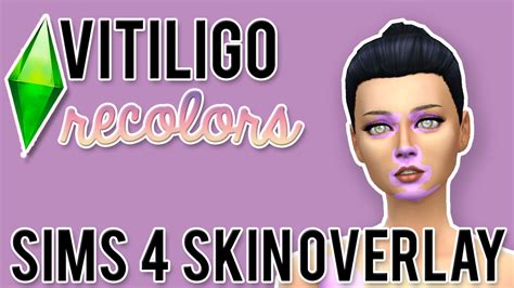 Vitiligo Skin Overlay Sims 4