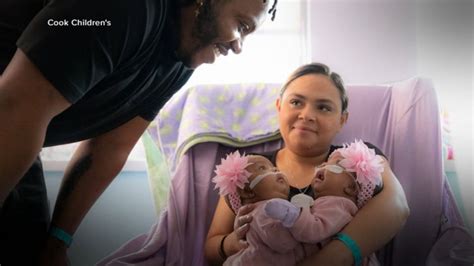 Video Conjoined 3 Month Old Twins Undergo Successful Separation Surgery