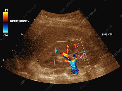 Healthy Kidney Ultrasound Scan Stock Image P5500253 Science