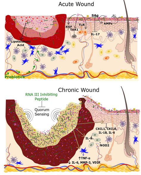 Ijms Free Full Text The Cutaneous Microbiome And Wounds New