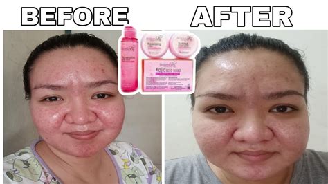 2 Month Update Brilliant Skin Essentials Rejuvenating Facial Set