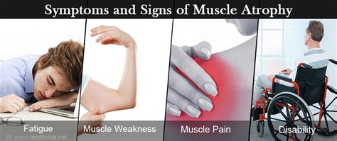 Muscle Atrophy Causes Symptoms Diagnosis Treatment And Prevention