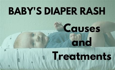Baby Diaper Rash Causes And Effective Ways To Treat Diaper Rash