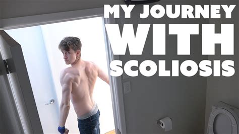 Scoliosis Fitness Life And Perspectives Youtube