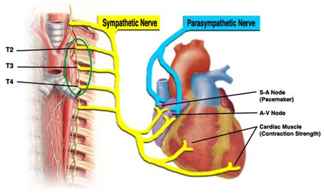 inima inervatie cabinet cardiologie deva dr benteu darius