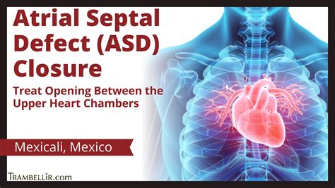 Atrial Septal Defect Asd Closure Treat Opening Between The Upper