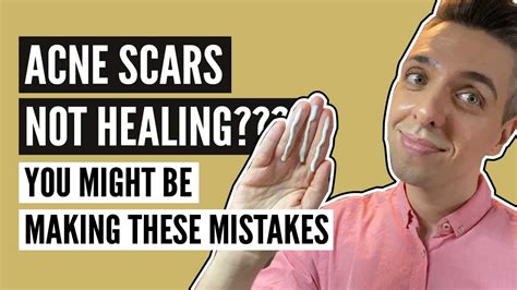 5 Reasons Your Acne Scars Arent Healing For Scars That Just Wont Go