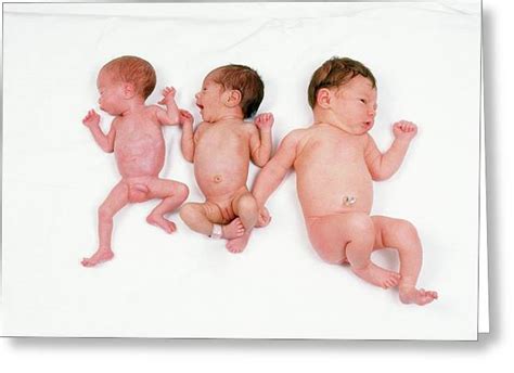Approximately 80% of all neonatal deaths and 50% of infant's death are related to lbw. Normal Baby And Two Low Birthweight Babies Photograph by ...